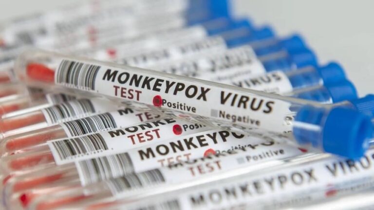 RDC – SANTÉ : Toutes les provinces congolaises touchées par la variole du singe